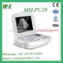 MSLPU28M High Technical Digital Protable Ultdrasound Scanner Doppler Ultrasound Machine